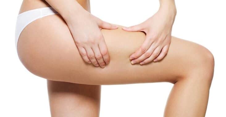 meilleurs produits anti cellulite